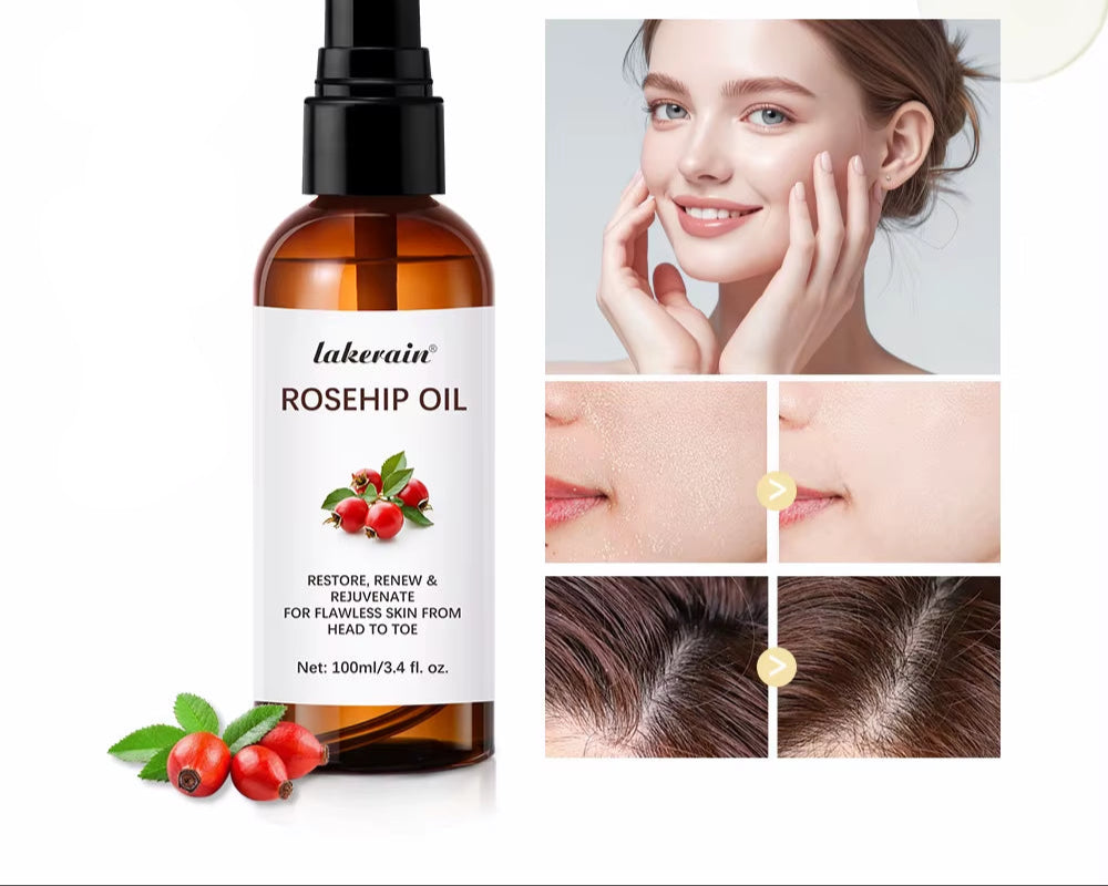 Organic Rosehip Oil Rose Hips Face Oils 30Ml Fast-Absorbing Skin Care Moisturizer Face Oil Organic Rosehip Seed Oil Essence